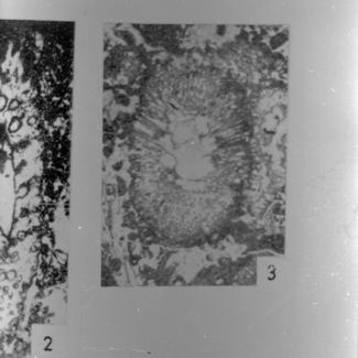 Palaeodasycladus mediterraneus (vapn. alga) 3